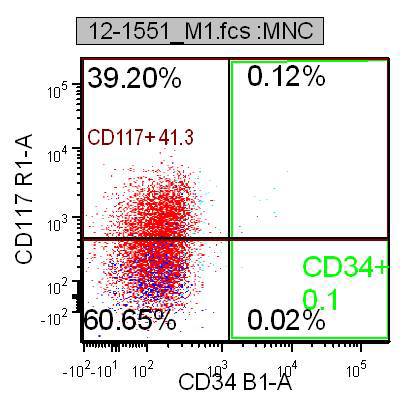 Figure 7b. Flow cytometry, Ethmoid sinus, CD117 dim, CD34-